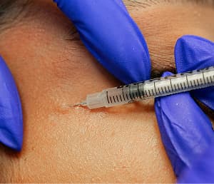$1 off a unit of Botox or Dysport